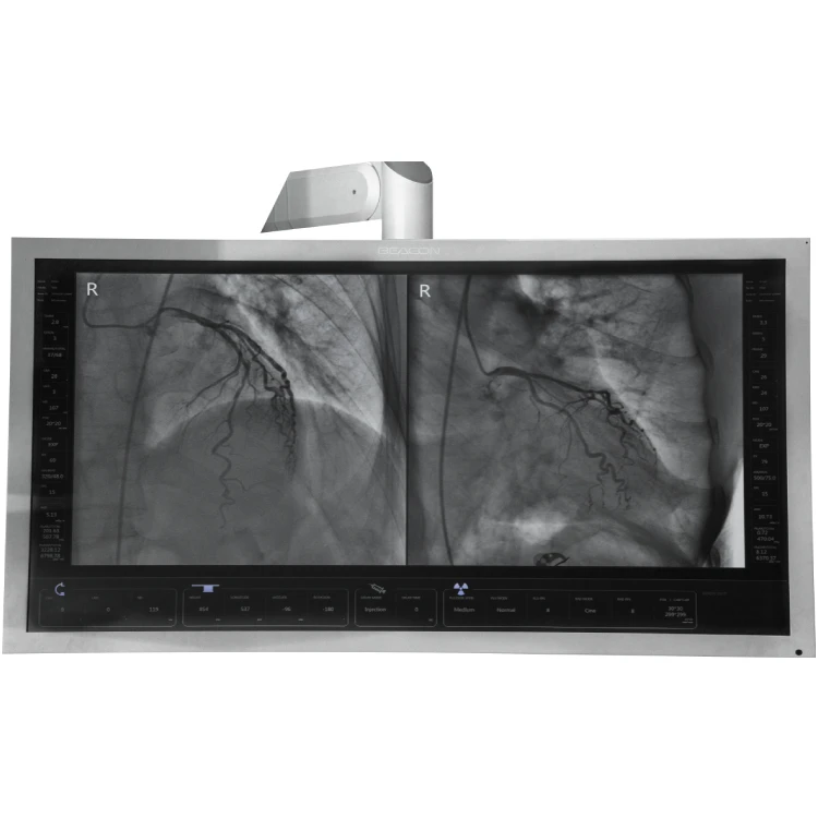 angiography machine